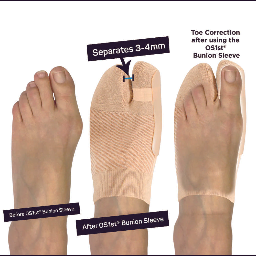 Bunion Bracing Sleeve (HV3) - Natural